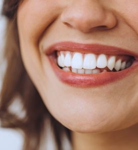 Sonrisa Implantes Dentales