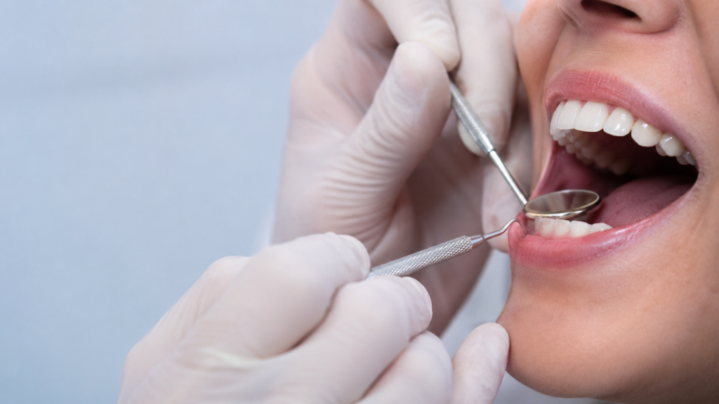 limpieza dental en Estepona